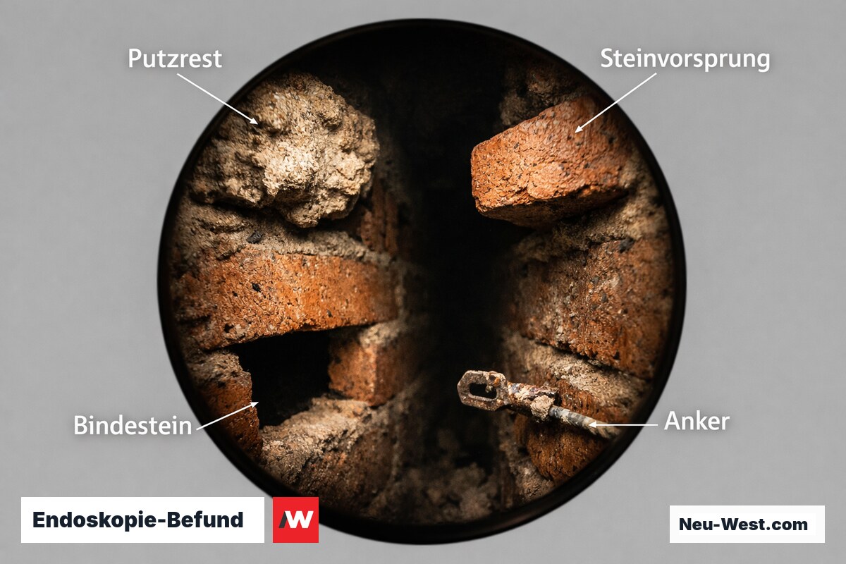Endoskopie-Befund: Typische Hindernisse und Befüllbarkeit im Hohlraum – Erklär-Grafik (NEUWEST Berlin)